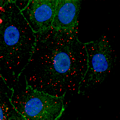 canal TRPV4, MDCK, ZO-1